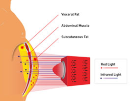 Presso-therapy for Weight-loss