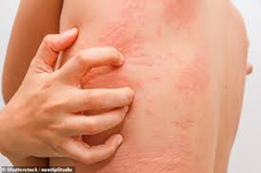 What damage can inflammation inflict on the skin