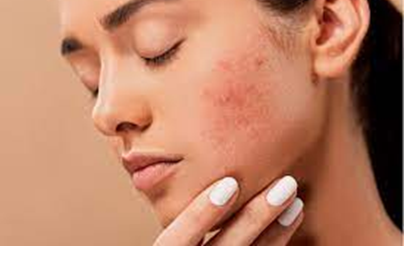 What visible signs of inflammation can you look out for